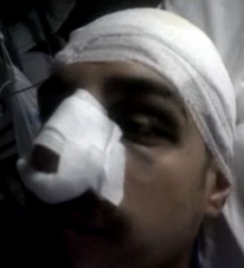 GUARDA VIDEO RAGAZZO TORTURATO DALLA POLIZIA